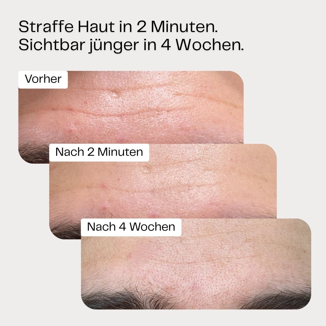 Black Deal: 3-für-2 Anti-Aging Face Cream