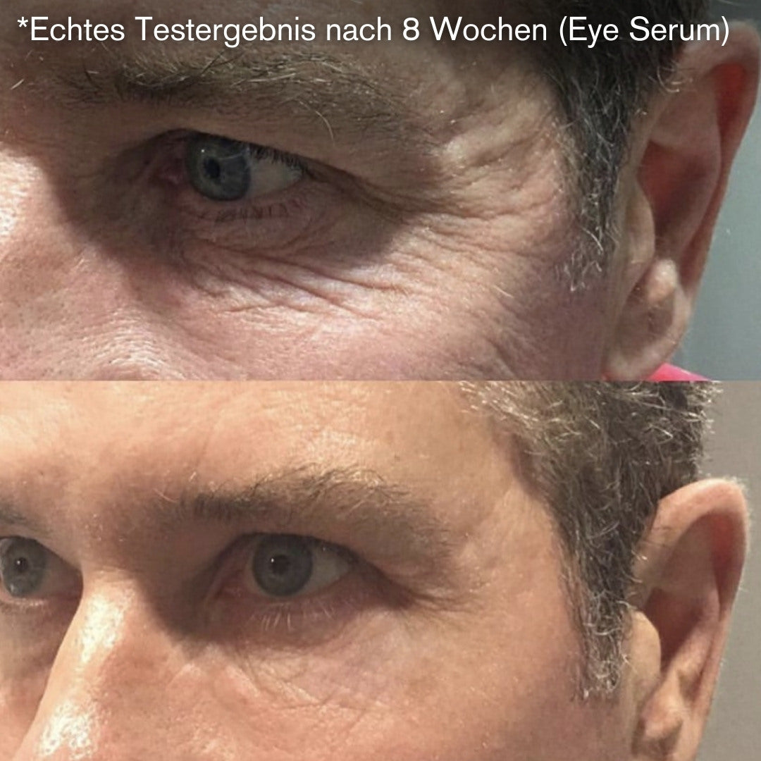 Einmaliges Angebot: 3-für-2 Deal Eye Serum