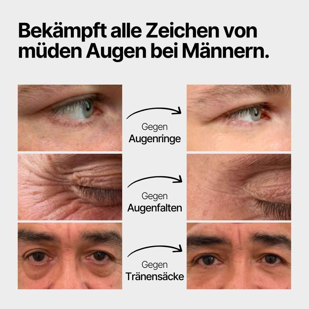 Einmaliges Angebot: 3-für-2 Deal Eye Serum